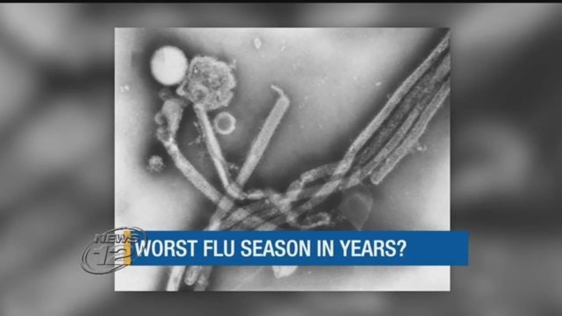 Experts say this year's flu season could be the worst in years