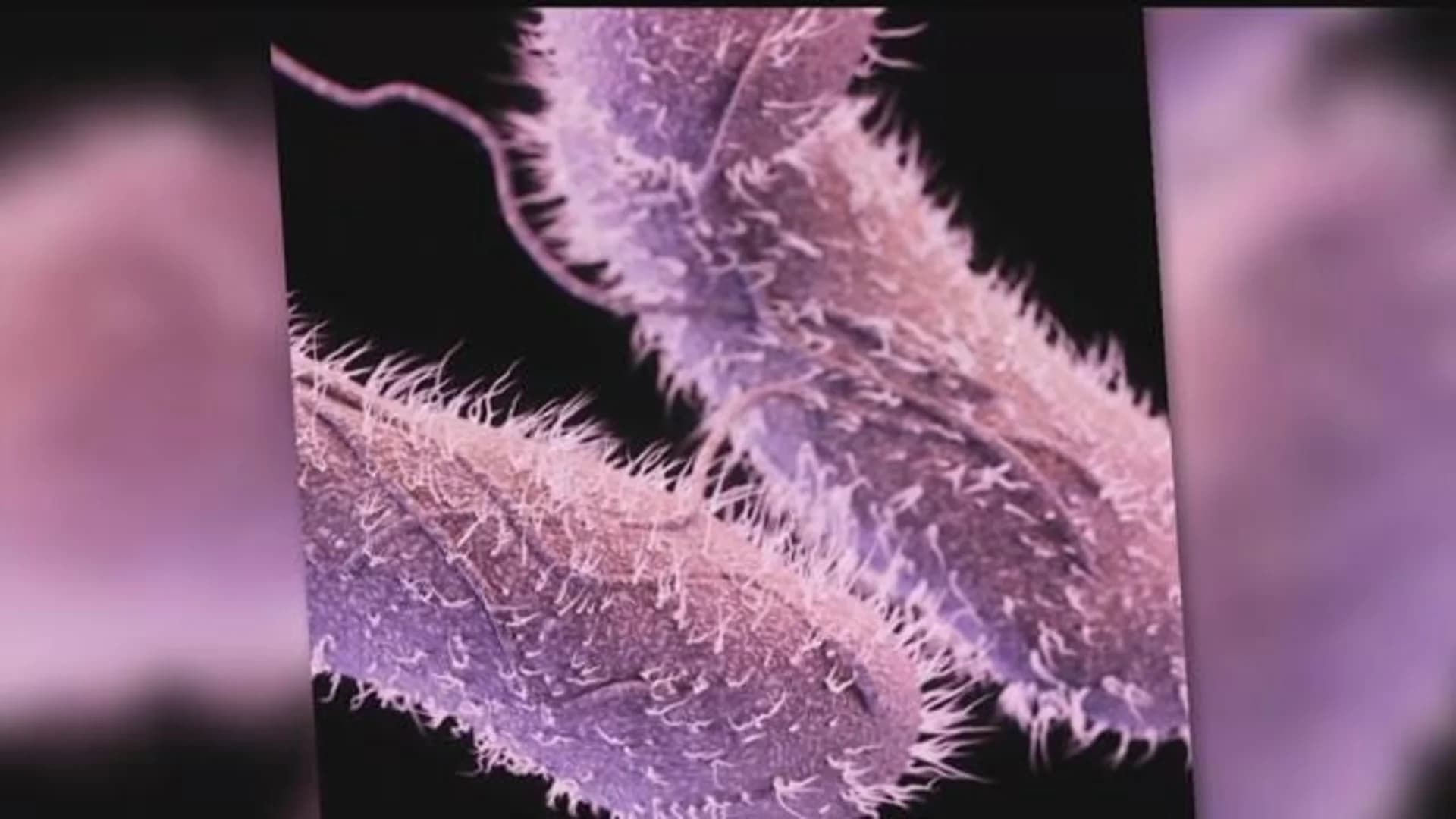 Effects of salmonella outbreak reach Connecticut