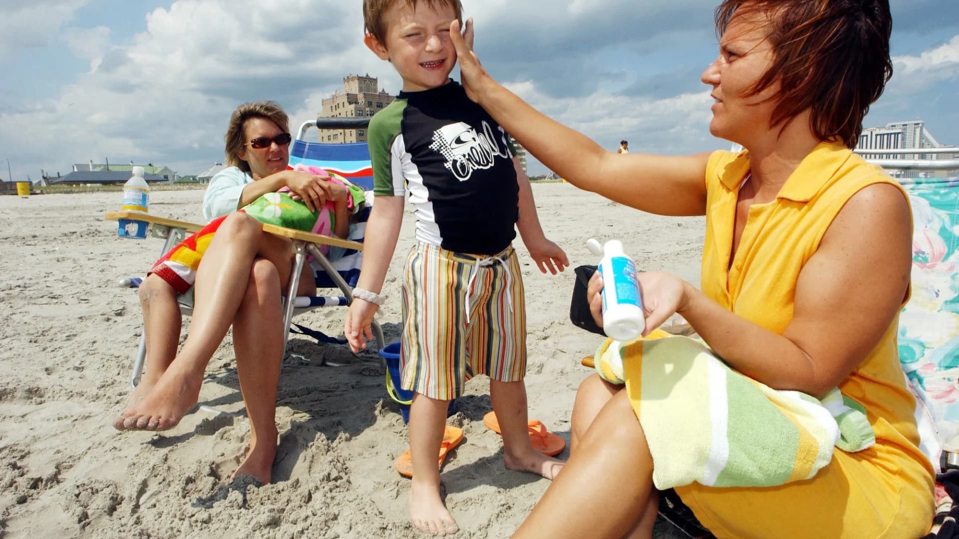 Spent some time in the sun? Here are 18 tips to treat sunburn in adults and children